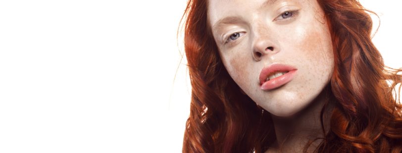 models-with-freckles