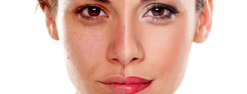 Models with Bad Skin